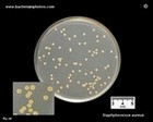 pigment in S.aureus